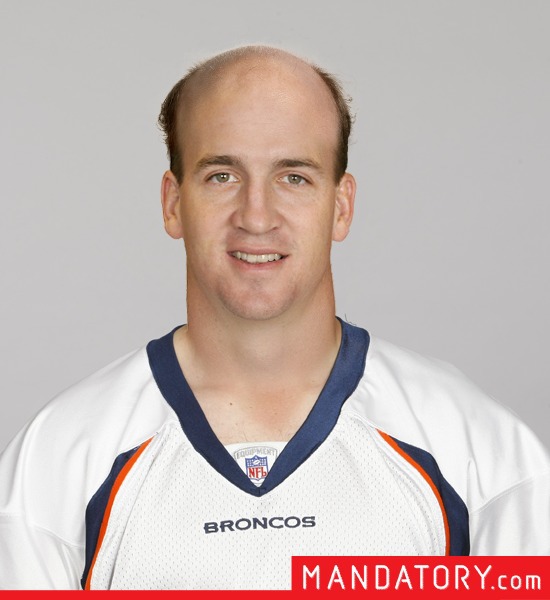 bald-quarterbacks-04-1