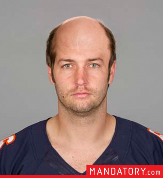 bald-quarterbacks-09-1